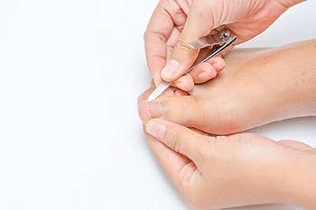 Managing Ingrown Toenails