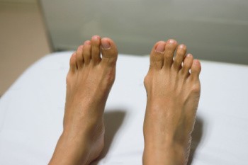 Causes and Care of Bunions in Kids