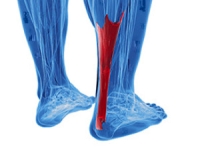How Severe Is My Achilles Tendon Injury?